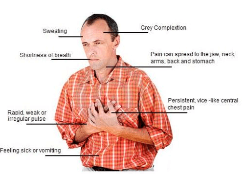 Heart attack symptoms Heart attack symptoms